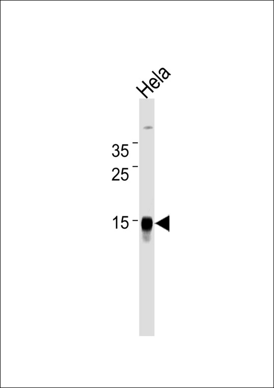 CDA Antibody western blot of HeLa cell line lysates (35 ug/lane). The CDA antibody detected the CDA protein (arrow).