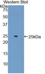 Western blot of recombinant ADCY6 / Adenylate Cyclase 6.