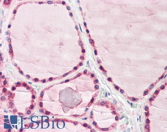 Anti-Adenylate Cyclase 6 / ADCY6 antibody IHC of human thyroid. Immunohistochemistry of formalin-fixed, paraffin-embedded tissue after heat-induced antigen retrieval. Antibody LS-B8105 dilution 5-10 ug/ml.