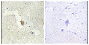 IHC of paraffin-embedded human brain tissue, using ADCY7 Antibody. The sample on the right was incubated with synthetic peptide.