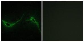 Immunofluorescence of NIH-3T3 cells, using ADCY7 Antibody. The sample on the right was incubated with synthetic peptide.