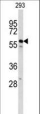 Western blot of CDC14B Antibody in 293 cell line lysates (35 ug/lane). CDC14B (arrow) was detected using the purified antibody.