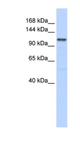 ADCY8 antibody LS-C111004 Western blot of 721_B cell lysate.