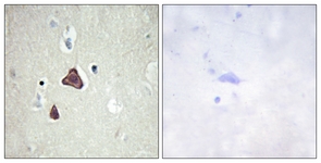 IHC of paraffin-embedded human brain tissue, using ADCY8 Antibody. The picture on the right is treated with the synthesized peptide.