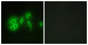 Immunofluorescence of A549 cells, using ADCY8 Antibody. The picture on the right is treated with the synthesized peptide.