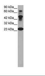 Western blot of Jurkat Cell Lysate.