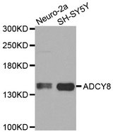 Western blot analysis of extracts of various cell lines, using ADCY8 antibody.