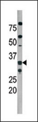 The anti-Phospho-Cdk2-T160 antibody is used in Western blot to detect Phospho-Cdk2-T160 in A2058 tissue lysate