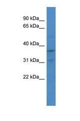 CDK2 antibody LS-C145256 Western blot of Jurkat Cell lysate. Antibody concentration 1 ug/ml.