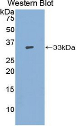 Western blot of recombinant ADCY9 / Adenylate Cyclase 9.