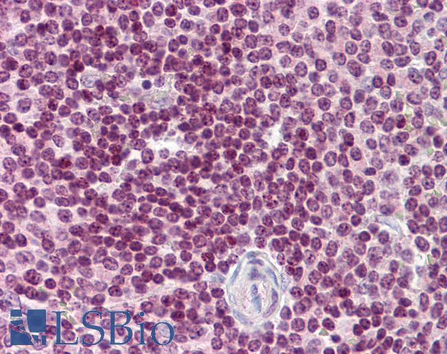 Anti-CDC20 antibody IHC of human spleen. Immunohistochemistry of formalin-fixed, paraffin-embedded tissue after heat-induced antigen retrieval. Antibody LS-B5877 concentration 5 ug/ml.