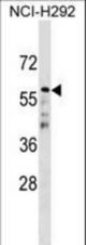 CDC20B Antibody western blot of NCI-H292 cell line lysates (35 ug/lane). The CDC20B antibody detected the CDC20B protein (arrow).