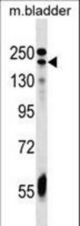 ADCY9 Antibody western blot of mouse bladder tissue lysates (35 ug/lane). The ADCY9 antibody detected the ADCY9 protein (arrow).