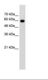 Jurkat Cell Lysate