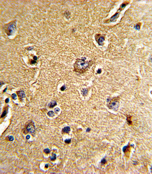 Formalin-fixed and paraffin-embedded human brain tissue reacted with CDC23 Antibody , which was peroxidase-conjugated to the secondary antibody, followed by DAB staining. This data demonstrates the use of this antibody for immunohistochemistry; clinical relevance has not been evaluated.