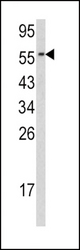 Western blot of CDC23 antibody in HL60 cell line lysates(35 ug/lane). CDC23 (arrow) was detected using the purified antibody.