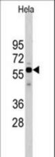 Western blot of Cdc25A antibody in HeLa cell line lysates (35 ug/lane). Cdc25A (arrow) was detected using the purified antibody.