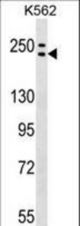 ADCY9 Antibody western blot of K562 cell line lysates (35 ug/lane). The ADCY9 antibody detected the ADCY9 protein (arrow).
