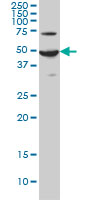 ADCYAP1R1 monoclonal antibody (M01), clone 2B12 Western Blot analysis of ADCYAP1R1 expression in HeLa.