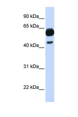 CDC25A antibody LS-C112297 Western blot of Fetal Brain lysate. Antibody concentration 1 ug/ml.