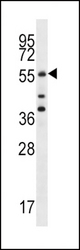 Cdc25A Antibody (S78) western blot of MCF-7 cell line lysates (35 ug/lane). The Cdc25A antibody detected the Cdc25A protein (arrow).