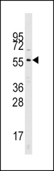 Western blot of Cdc25A antibody in mouse kidney tissue lysates (35 ug/lane). Cdc25A (arrow) was detected using the purified antibody.