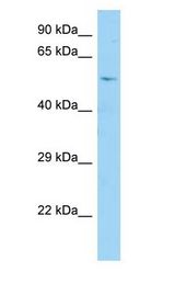 CDC25A antibody Western Blot of Fetal Brain.