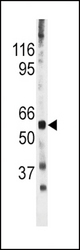The anti-Phospho-CDC25A-S278 antibody is used in Western blot to detect Phospho-CDC25A-S278 in mouse heart tissue lysate