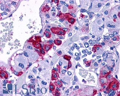 Anti-ADCYAP1R1 antibody LS-A946 IHC of human brain, pituitary. Immunohistochemistry of formalin-fixed, paraffin-embedded tissue after heat-induced antigen retrieval.