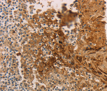 Immunohistochemistry of paraffin-embedded human tonsil tissue using ADCYAP1R1 antibody.