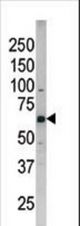 The anti-Phospho-CDC25B-S187 antibody is used in Western blot to detect Phospho-CDC25B-S187 in SK-BR-3 tissue lysate