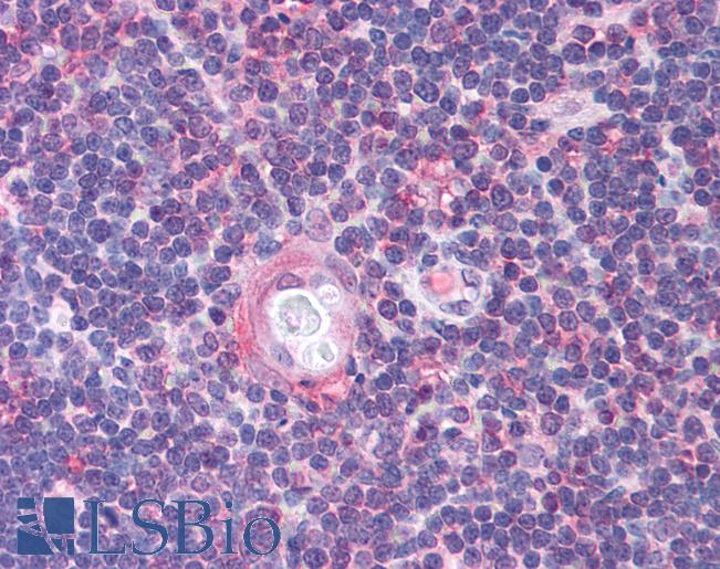Anti-CDC25B antibody IHC of human thymus. Immunohistochemistry of formalin-fixed, paraffin-embedded tissue after heat-induced antigen retrieval. Antibody LS-B931 concentration 5 ug/ml.