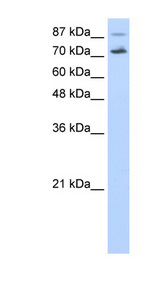 CDC25B antibody LS-B931 Western blot of HepG2 cell lysate.