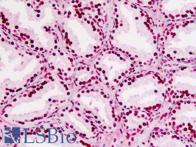 Human Prostate: Formalin-Fixed, Paraffin-Embedded (FFPE)