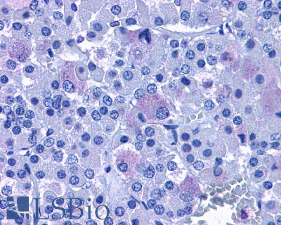Anti-ADCYAP1R1 antibody LS-A948 IHC of human brain, pituitary. Immunohistochemistry of formalin-fixed, paraffin-embedded tissue after heat-induced antigen retrieval.