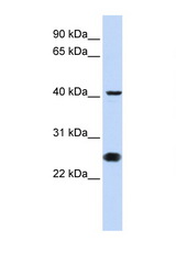 CDC25C antibody LS-C102827 Western blot of Jurkat Cell lysate. Antibody concentration 1 ug/ml.