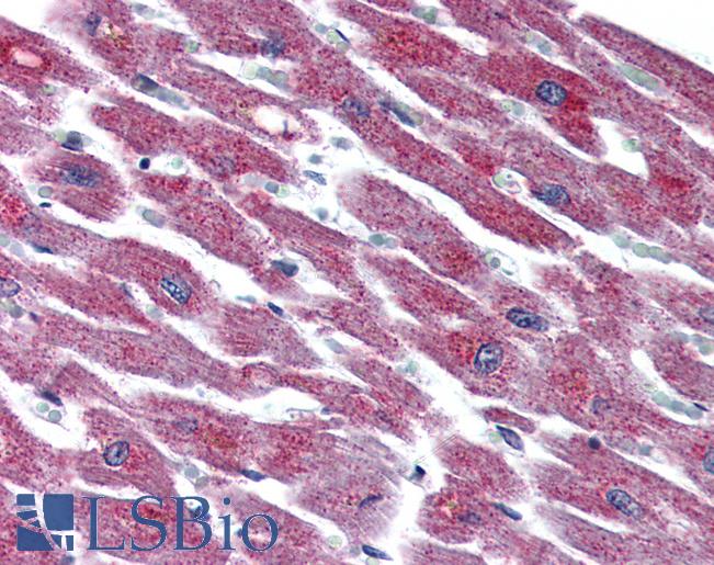 Anti-ADCYAP1R1 antibody LS-A944 IHC of human heart. Immunohistochemistry of formalin-fixed, paraffin-embedded tissue after heat-induced antigen retrieval.