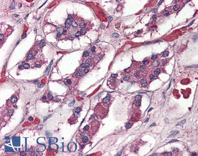 Anti-ADCYAP1R1 / PAC1 Receptor antibody IHC of human brain, pituitary. Immunohistochemistry of formalin-fixed, paraffin-embedded tissue after heat-induced antigen retrieval.