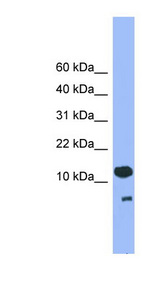 CDC26 antibody LS-C116822 Western blot of Placenta lysate.