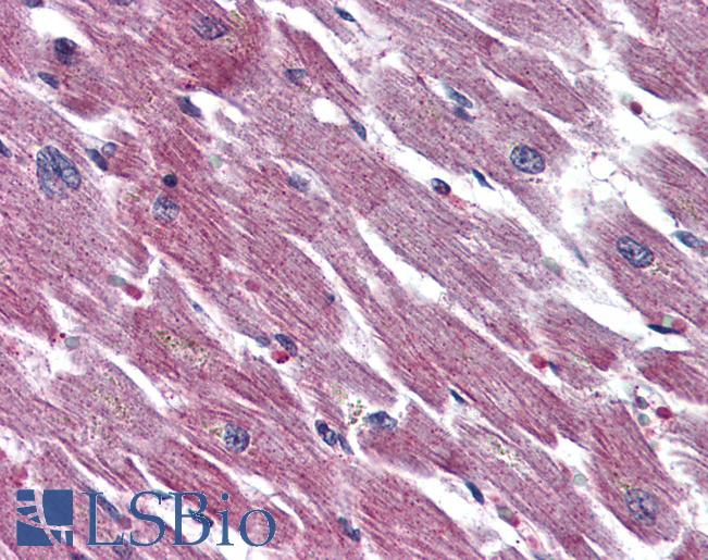 Anti-ADCYAP1R1 antibody LS-A945 IHC of human heart. Immunohistochemistry of formalin-fixed, paraffin-embedded tissue after heat-induced antigen retrieval.