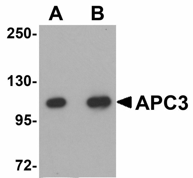 Western blot of APC3 in mouse liver tissue lysate with APC3 antibody at (A) 1 and (B) 2 ug/ml.