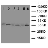 WB of CDC34 antibody. Lane 1: Rat Testis Tissue Lysate. Lane 2: HELA Cell Lysate. Lane 3: NIH3T3 Cell Lysate. Lane 4: SMMC Cell Lysate. Lane 5: 293T Cell Lysate. Lane 6: A549 Cell Lysate..