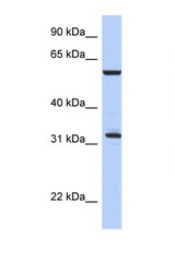 CDC34 antibody LS-C112299 Western blot of Fetal Thymus lysate. Antibody concentration 1 ug/ml.