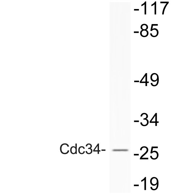 Western blot of Cdc34 antibody in extracts from COLO205 cells treated with Forskolin.