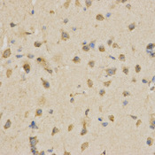 Immunohistochemistry of paraffin-embedded mouse brain using CDC34 antibody at dilution of 1:200 (x400 lens).