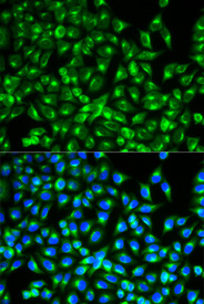 Immunofluorescence analysis of MCF-7 cell using CDC34 antibody. Blue: DAPI for nuclear staining.