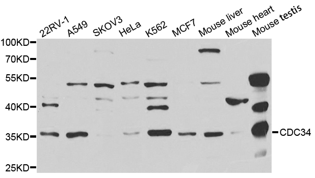 Western blot analysis of extracts of various cell lines, using CDC34 antibody.