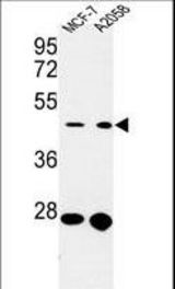 Western blot of CDC37 Antibody in MCF-7, A2058 cell line lysates (35 ug/lane). CDC37 (arrow) was detected using the purified antibody.