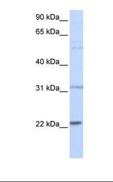 721_B cell lysate. Antibody concentration: 1.0 ug/ml. Gel concentration: 12%.