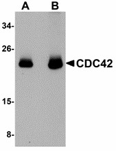 Western blot of CDC42 in human brain tissue lysate with CDC42 antibody at (A) 0.5 and (B) 1 ug/ml.